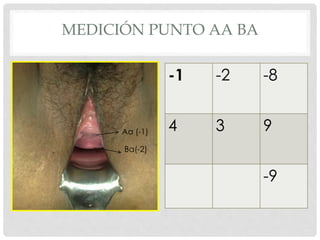 Aa (-1)
Ba(-2)
-1 -2 -8
4 3 9
-9
MEDICIÓN PUNTO AA BA
 