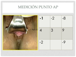 Ap(-2)
-1 -2 -8
4 3 9
-2 -9
MEDICIÓN PUNTO AP
 