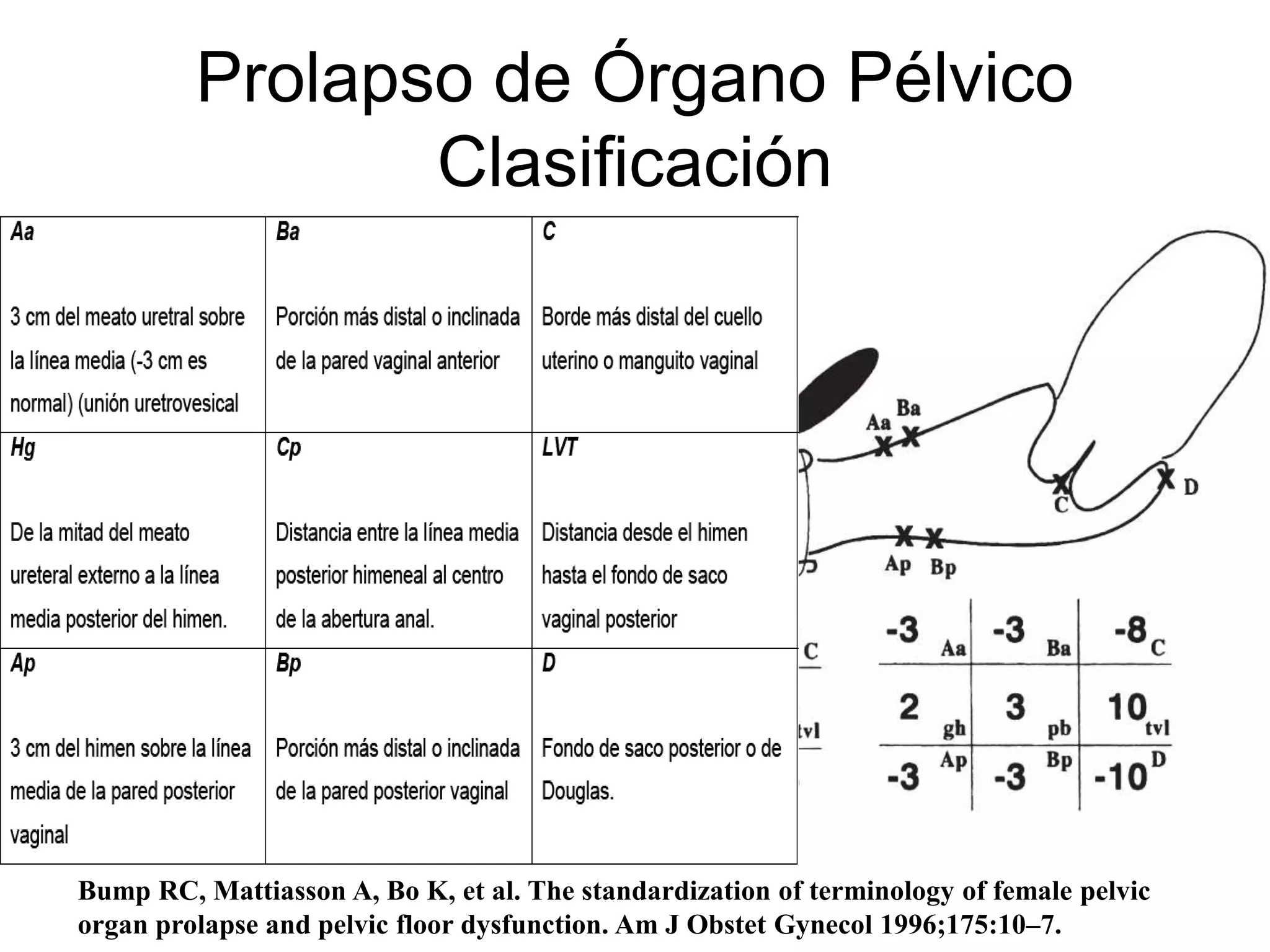 Prolapso genital | PPTX | Reproductive Health | Diseases and Conditions