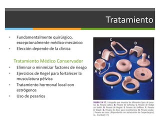 Tratamiento
 Fundamentalmente quirúrgico,
excepcionalmente médico-mecánico
 Elección depende de la clínica
Tratamiento Médico Conservador
 Eliminar o minimizar factores de riesgo
 Ejercicios de Kegel para fortalecer la
musculatura pélvica
 Tratamiento hormonal local con
estrógenos
 Uso de pesarios
 