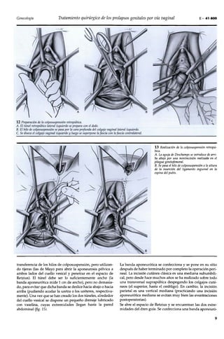 Prolapso genital cirugia | PDF