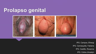 Prolapso genital
IPG. Campos, Efrangi
IPG. Carrasquilla, Fabiana
IPG. Castillo, Roxanna
IPG. Colina Jhoselyn
 