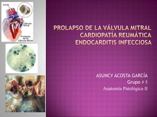 ASUNCY ACOSTA GARCÍA
Grupo # 5
Anatomía Patológica II

 