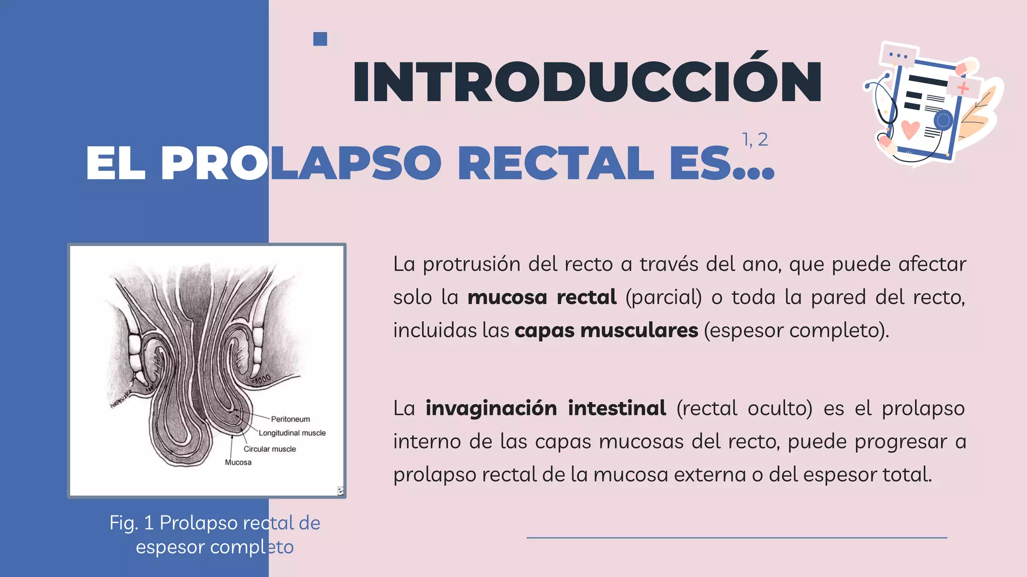 Prolapso Rectal PPT
