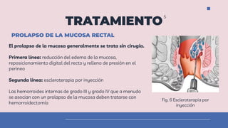 Prolapso Rectal | PDF