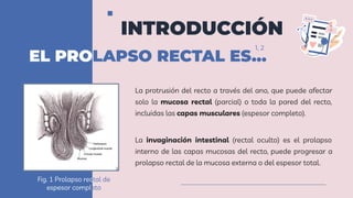 Prolapso Rectal PDF prolapso-rectal-pdf