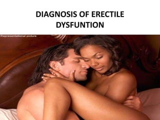 DIAGNOSIS OF ERECTILE
DYSFUNTION
 