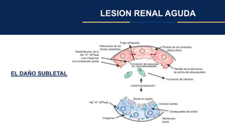 LESION RENAL AGUDA
EL DAÑO SUBLETAL
 