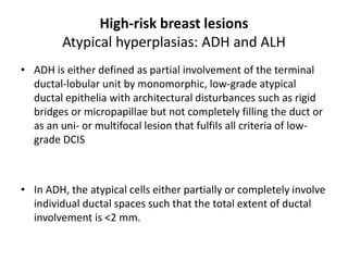 High-risk breast lesions
Atypical hyperplasias: ADH and ALH
• ADH is either defined as partial involvement of the terminal
ductal-lobular unit by monomorphic, low-grade atypical
ductal epithelia with architectural disturbances such as rigid
bridges or micropapillae but not completely filling the duct or
as an uni- or multifocal lesion that fulfils all criteria of low-
grade DCIS
• In ADH, the atypical cells either partially or completely involve
individual ductal spaces such that the total extent of ductal
involvement is <2 mm.
 
