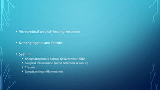 • Vitreoretinal wound-healing response
• Nonangiogenic and fibrotic
• Seen in:
• Rhegmatogenous Retinal Detachment (RRD)
• Surgical intervention (most common scenario)
• Trauma
• Longstanding inflammation
 