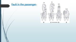 Fault in the passenger-
 