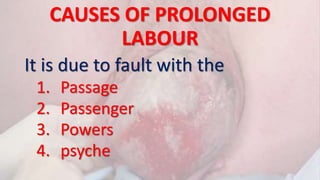 CAUSES OF PROLONGED
LABOUR
It is due to fault with the
1. Passage
2. Passenger
3. Powers
4. psyche
 