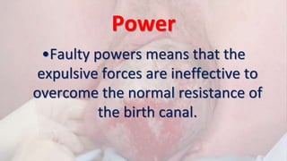 Power
•Faulty powers means that the
expulsive forces are ineffective to
overcome the normal resistance of
the birth canal.
 