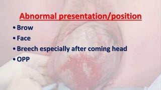 Abnormal presentation/position
•Brow
•Face
•Breech especially after coming head
•OPP
 