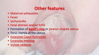 Other features
• Maternal exhaustion
• Fever
• tachycardia
• Fetal distress and/or IUFD
• Formation of bandl’s ring or peanut shaped uterus
• Tonic inertia of the uterus
• Excessive Caput formation
• Excessive molding
• Vulvae oedema
 