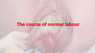 The course of normal labour
 