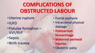 COMPLICATIONS OF
OBSTRUCTED LABOUR
•Uterine rupture
•IUFD
•Fistulae formation –
VVF/RVF
•Sepsis
•Birth trauma
• Foetal asphyxia
• Intracranial physical
damage
• Postpartum
hemorrhage
• Maternal perineal
injuries
• Obstetric palsy
 