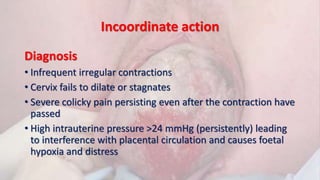 Incoordinate action
Diagnosis
• Infrequent irregular contractions
• Cervix fails to dilate or stagnates
• Severe colicky pain persisting even after the contraction have
passed
• High intrauterine pressure >24 mmHg (persistently) leading
to interference with placental circulation and causes foetal
hypoxia and distress
 