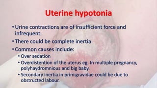 Uterine hypotonia
• Urine contractions are of insufficient force and
infrequent.
• There could be complete inertia
• Common causes include:
• Over sedation
• Overdistention of the uterus eg. In multiple pregnancy,
polyhaydromnious and big baby.
• Secondary inertia in primigravidae could be due to
obstructed labour.
 