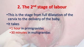 2. The 2nd stage of labour
•This is the stage from full dilatation of the
cervix to the delivery of the baby.
•It takes
•1 hour in primigravidas
•30 minutes in multigravidas
 