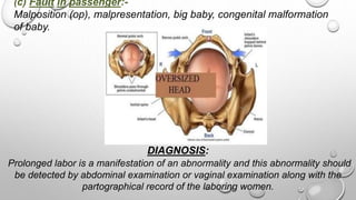 (c) Fault in passenger:-
Malposition (op), malpresentation, big baby, congenital malformation
of baby.
DIAGNOSIS:
Prolonged labor is a manifestation of an abnormality and this abnormality should
be detected by abdominal examination or vaginal examination along with the
partographical record of the laboring women.
 