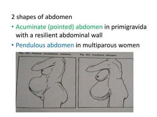 2 shapes of abdomen
• Acuminate (pointed) abdomen in primigravida
with a resilient abdominal wall
• Pendulous abdomen in multiparous women
 