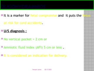 05/17/2025
Tesloach James
OLIGOHYDRAMNIOS
 It is a marker for fetal compromise and it puts the fetus
at risk for cord accidents.
 U/S diagnosis :
 No vertical pocket > 2 cm or
 Amniotic fluid index (AFI) 5 cm or less .
 It is considered an indication for delivery.
 