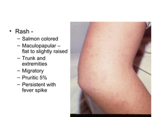Prolong fever editted | PPT