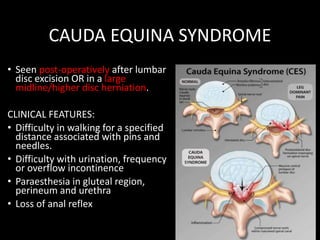 CAUDA EQUINA SYNDROME
• Seen post-operatively after lumbar
disc excision OR in a large
midline/higher disc herniation.
CLINICAL FEATURES:
• Difficulty in walking for a specified
distance associated with pins and
needles.
• Difficulty with urination, frequency
or overflow incontinence
• Paraesthesia in gluteal region,
perineum and urethra
• Loss of anal reflex
 