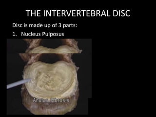 THE INTERVERTEBRAL DISC
Disc is made up of 3 parts:
1. Nucleus Pulposus
2. Annulus Fibrosis
3. Cartilage plates
 