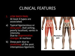 CLINICAL FEATURES
1. LOW BACK PAIN:
At least 4 types are
associated.
a) Typical ligamentous or
deep pain. Dull aching,
poorly localised, varies in
intensity.
Due to degenerative
changes in nucleus
b) Deep pain due to
stretching of the post.
interspinous ligament.
 