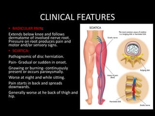 CLINICAL FEATURES
• RADICULAR PAIN:
Extends below knee and follows
dermatome of involved nerve root.
Pressure on root produces pain and
motor and/or sensory signs.
• SCIATICA:
Pathognomic of disc herniation.
Pain- Gradual or sudden in onset.
Gnawing or burning- continuously
present or occurs paroxysmally.
Worse at night and while sitting.
Pain starts in back and spreads
downwards.
Generally worse at he back of thigh and
hip.
 