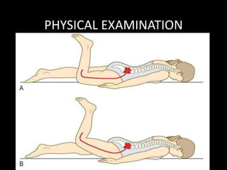 PHYSICAL EXAMINATION
6. Femoral nerve stretch test:
Seen in cases of disc prolapse at higher levels. (when
roots of femoral nerve involved)
Reverse SLRT
Patient placed prone and knee is flexed and hip
extended.
Pain produced over anterior thigh.
 