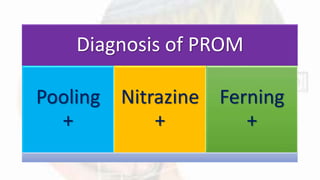 Pooling Sign Prom Prom | PPTX
