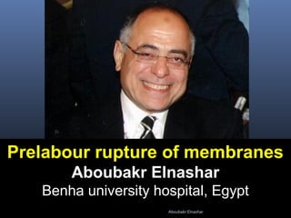 Prelabour rupture of membranes
Aboubakr Elnashar
Benha university hospital, Egypt
Aboubakr Elnashar
 