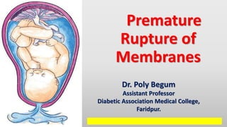 Premature
Rupture of
Membranes
Dr. Poly Begum
Assistant Professor
Diabetic Association Medical College,
Faridpur.
 
