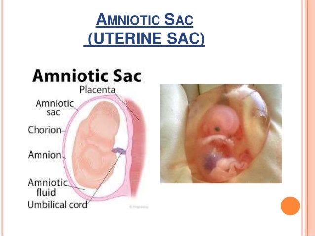 Pre Mature Rupture Of Membrene