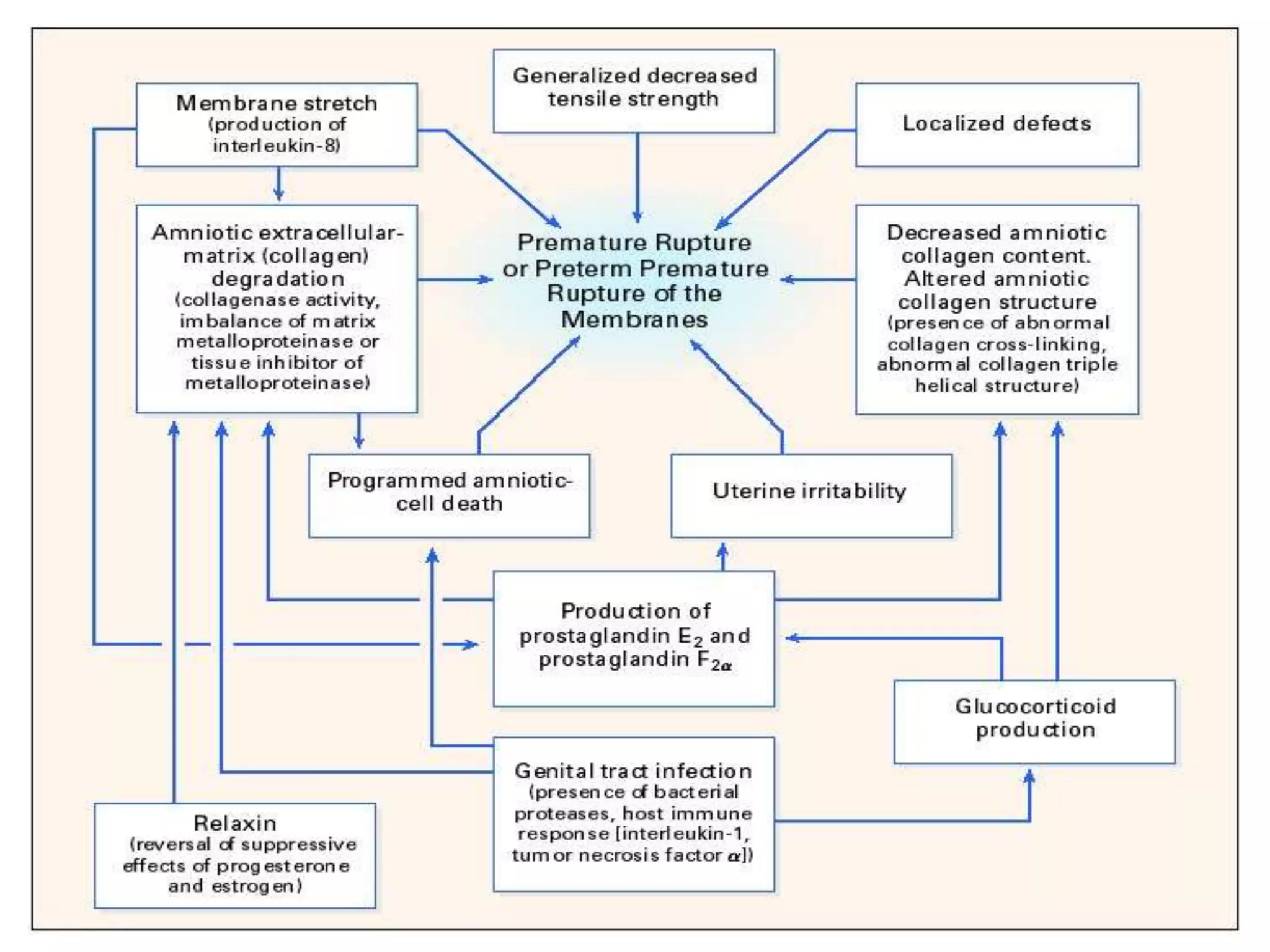 Pre-Labor Rupture of Membranes (PROM) | PPTX