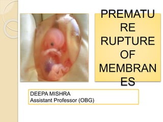 PREMATU
RE
RUPTURE
OF
MEMBRAN
ES
DEEPA MISHRA
Assistant Professor (OBG)
 