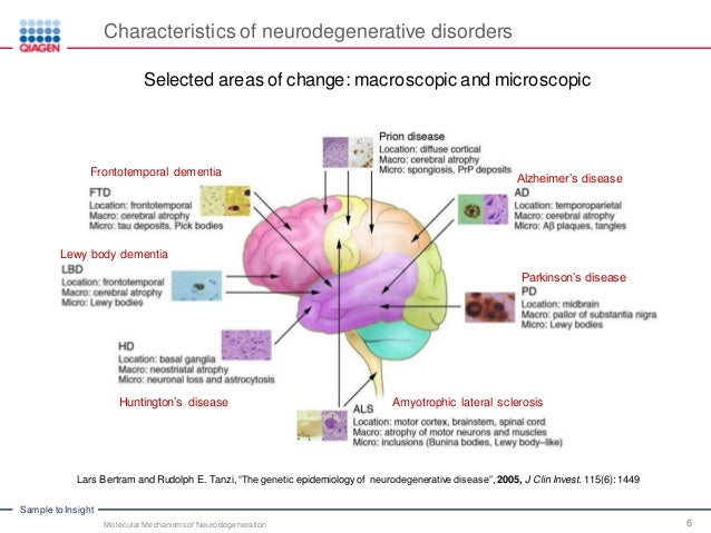 disease mechanisms of 7 Neurodegeneration Molecular of Mechanisms disease mechanisms of 7 Neurodegeneration Molecular of Mechanisms