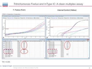 Sample to Insight
T. Foetus (Fam) Internal Control (Yellow)
TH = 0.05
Tritrichomonas Foetus and InType IC: A clean multiplex assay
Pathogen detection with HRM and multiplex RT-qPCR 30
 