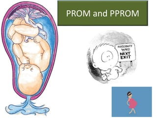 PROM and PPROM
 