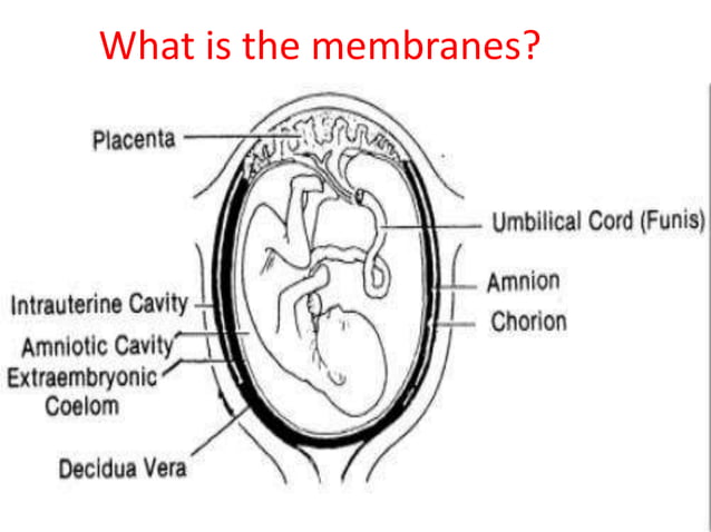 Premature rupture of membranes (PROM) | PPTX
