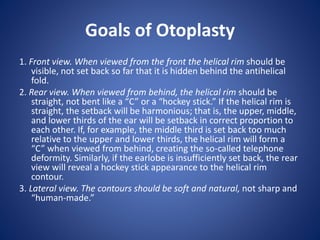 Goals of Otoplasty
1. Front view. When viewed from the front the helical rim should be
visible, not set back so far that it is hidden behind the antihelical
fold.
2. Rear view. When viewed from behind, the helical rim should be
straight, not bent like a “C” or a “hockey stick.” If the helical rim is
straight, the setback will be harmonious; that is, the upper, middle,
and lower thirds of the ear will be setback in correct proportion to
each other. If, for example, the middle third is set back too much
relative to the upper and lower thirds, the helical rim will form a
“C” when viewed from behind, creating the so-called telephone
deformity. Similarly, if the earlobe is insufficiently set back, the rear
view will reveal a hockey stick appearance to the helical rim
contour.
3. Lateral view. The contours should be soft and natural, not sharp and
“human-made.”
 