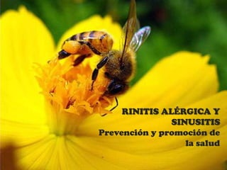 RINITIS ALÉRGICA Y
SINUSITIS
Prevención y promoción de
la salud
POR: Daniela A. Torres G.
Infomed

 