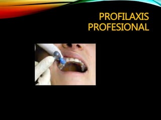 PROFILAXIS
PROFESIONAL
 