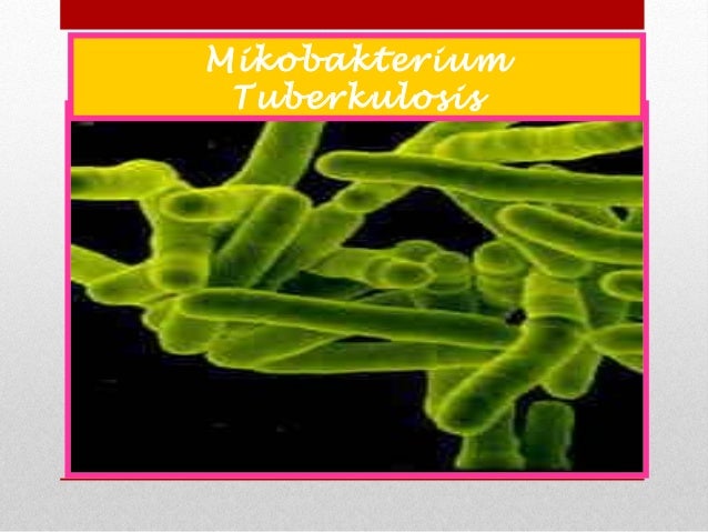 Promosi Kes & Pencegahan TB