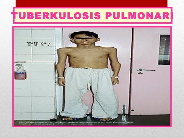 Ubat Batuk Anak 3 Tahun - Rawatan h
