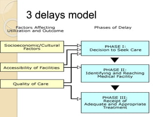 3 delays model 
