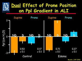 Dual  Effect of Prone Position on Ppl Gradient in ALI 0 3 -3 Ppl (cm H 2 O) Supine Supine Prone Prone Control Edema Mutoh, JAP 1992 0.53 ± 0.1 D 0.17 ± 0.1 D 0.71 ± 0.1 D 0.27 ± 0.1 D ND ND ND ND Denver Health 